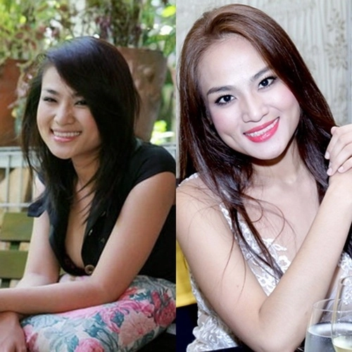 Duyên anh idol cười đơ sau khi tiêm botox - 1