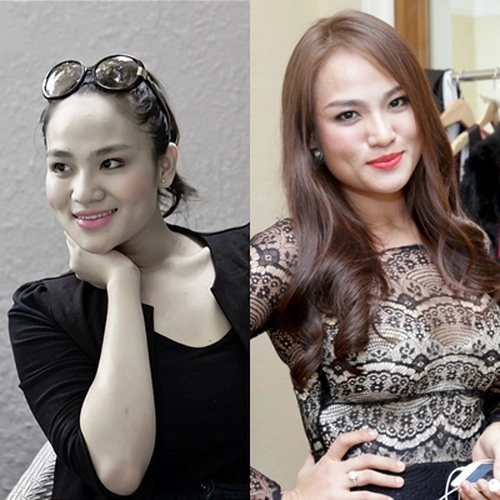 Duyên anh idol cười đơ sau khi tiêm botox - 2