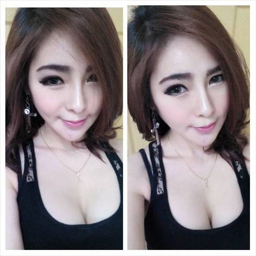 Những ca tử vong biến dạng vì phẫu thuật thẩm mỹ - 1