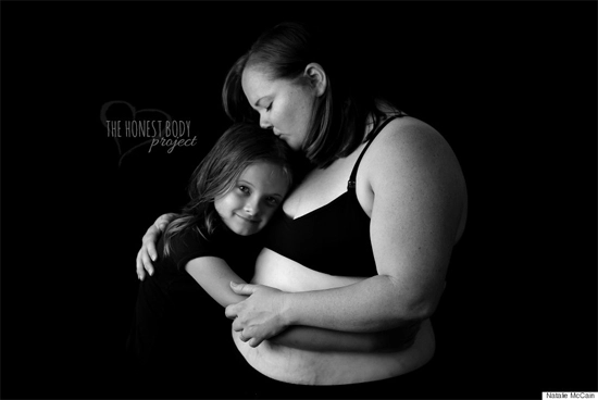 Bộ ảnh chân thực về cơ thể phụ nữ sau sinh - 13