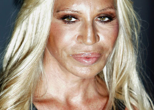 Donatella versace sau 20 năm lạm dụng dao kéo - 9