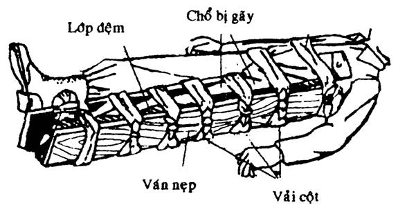 Hướng dẫn sơ cứu các tai nạn trên đường phượt - 6