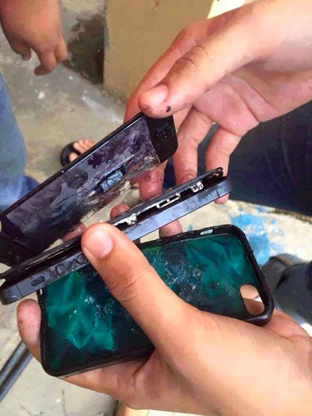 Iphone 5 phát nổ nam thanh niên bị bỏng nặng - 2