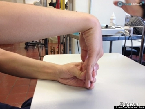 Liệu pháp giảm đau cho tay khi sử dụng smartphone quá nhiều - 7