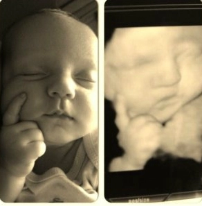 Hình ảnh của bé khi siêu âm và lúc đã chào đời - 2