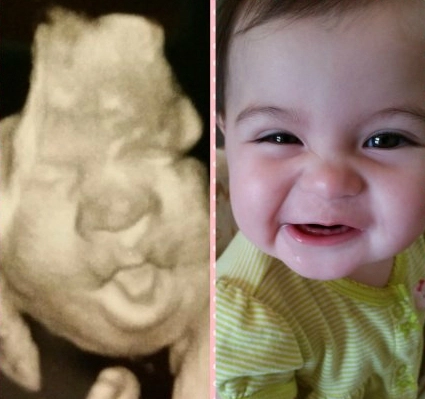 Hình ảnh của bé khi siêu âm và lúc đã chào đời - 4