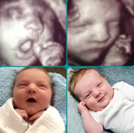 Hình ảnh của bé khi siêu âm và lúc đã chào đời - 5