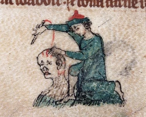 Những cách chữa bệnh đáng sợ thời trung cổ - 2