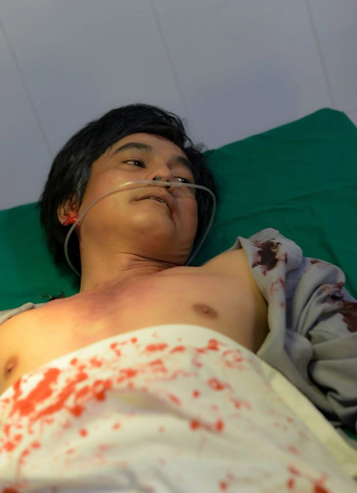 Vì phim mới hoài lâm phải bị đánh phải băng đầu nhập viện - 13