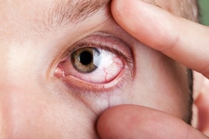 8 tình trạng của mắt cảnh báo bạn đang mắc bệnh hiểm nghèo - 1