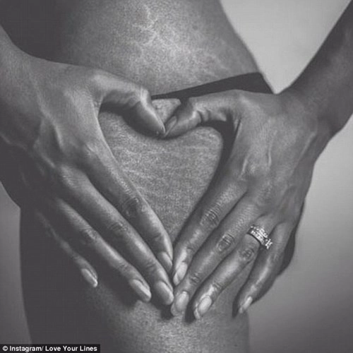 Bật khóc với những hình ảnh biết nói về cơ thể người mẹ sau sinh - 1