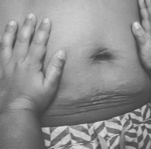 Bật khóc với những hình ảnh biết nói về cơ thể người mẹ sau sinh - 11