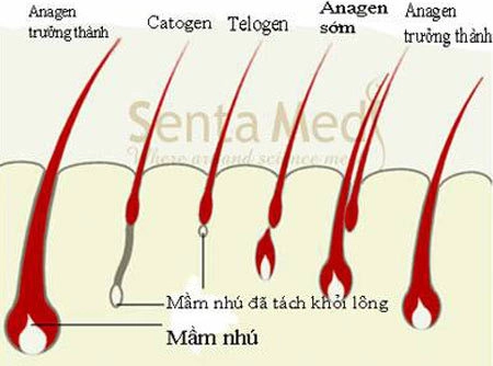 Chuẩn bị mang thai có nên triệt lông - 1