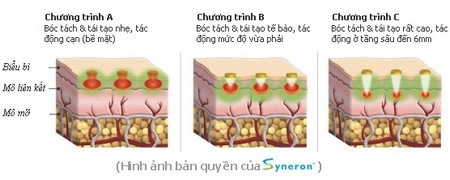 Công nghệ mới xóa nhăn xóa sẹo không cần phẫu thuật - 2