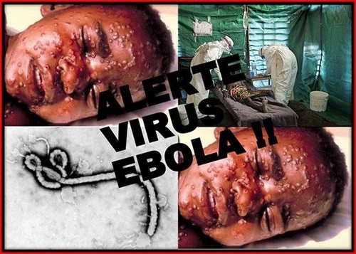 Dấu hiệu nhận biết sớm người nhiễm ebola trong thời gian ủ bệnh - 1