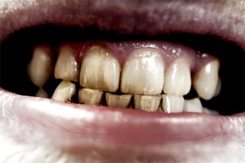Hiểu 1001 sự thật về răng miệng sẽ giúp bạn tỏa sáng như nữ thần - 1