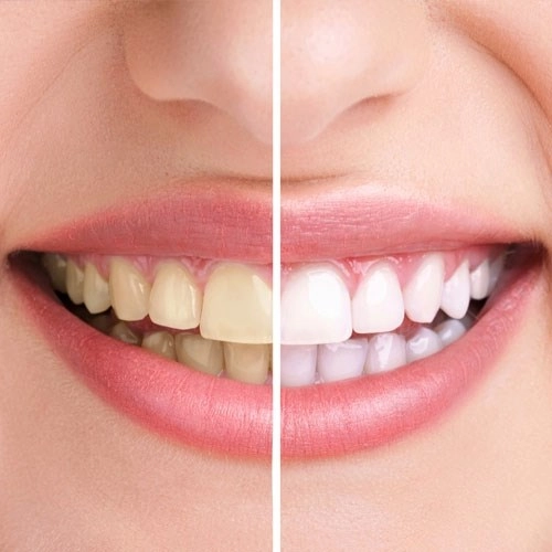 Hiểu 1001 sự thật về răng miệng sẽ giúp bạn tỏa sáng như nữ thần - 3