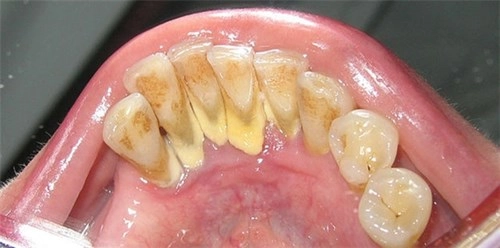 Hiểu 1001 sự thật về răng miệng sẽ giúp bạn tỏa sáng như nữ thần - 5