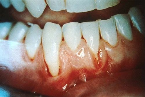 Hiểu 1001 sự thật về răng miệng sẽ giúp bạn tỏa sáng như nữ thần - 6