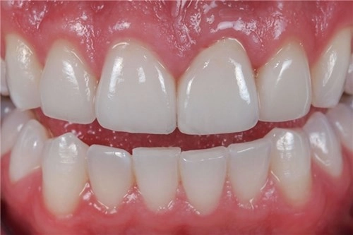 Hiểu 1001 sự thật về răng miệng sẽ giúp bạn tỏa sáng như nữ thần - 10