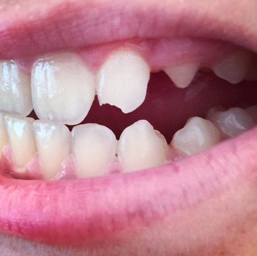 Hiểu 1001 sự thật về răng miệng sẽ giúp bạn tỏa sáng như nữ thần - 11