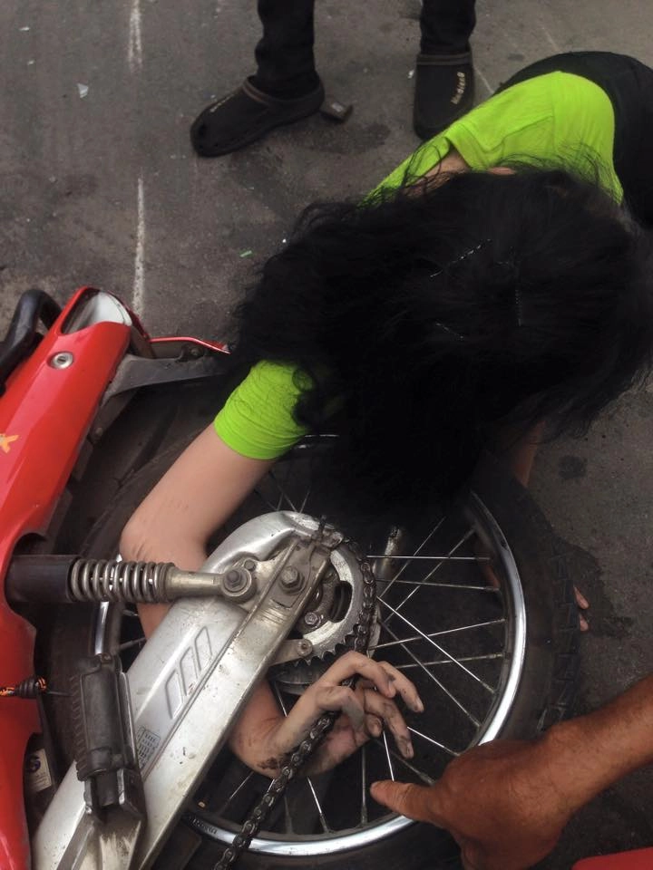 Tai nạn khiến cô gái xinh đẹp bị dính cánh tay vào bánh xe wave - 2