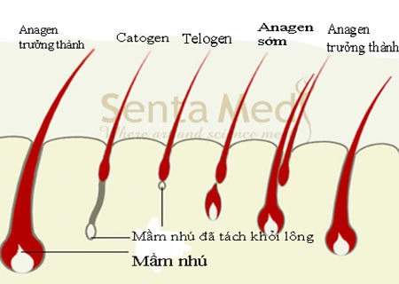 Ưu điểm của dịch vụ triệt lông phiên bản 5 - 1