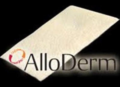 Vật liệu alloderm mới cho nâng mũi - 1