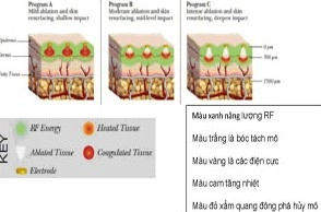 Xóa nhăn và sẹo bằng công nghệ matrix-rf - 1