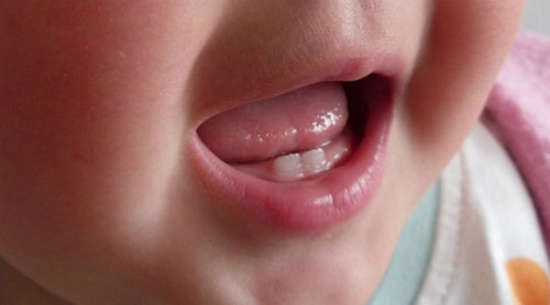 Bé chậm mọc răng có phải do thiếu chất - 1