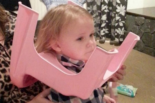 Bé gái 2 tuổi mắc kẹt đầu vào ghế ngồi bô - 1