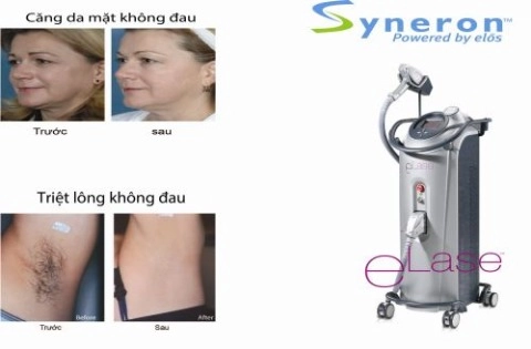 Căng da mặt không đau bằng laser - 2