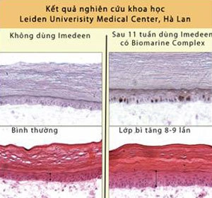 Hiệu quả sử dụng collagen dưới góc độ khoa học - 2