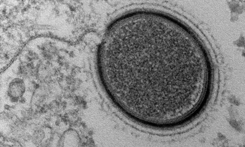 Hôi sinh virus cổ đại 30000 năm tuôi - 1