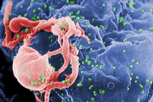 Lý giải trường hợp duy nhất được chữa khỏi hiv trên thế giới - 3