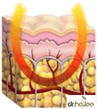 Nâng cơ vùng mắt miễn phí - 2