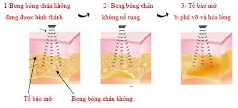 Ngấn mỡ nọng cằm dấu hiệu của tuổi già - 2