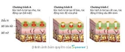 Phương pháp xóa sẹo thâm do mụn trứng cá - 2