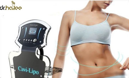 Ưu điểm của hút mỡ không phẫu thuật cavi lipo - 1