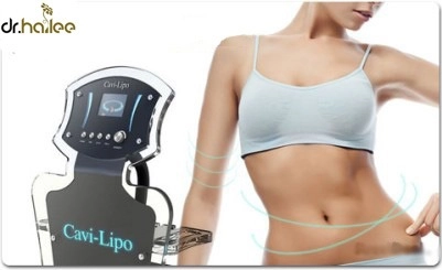 Hút mỡ không phẫu thuật với cavi-lipo và bùn khoáng - 1