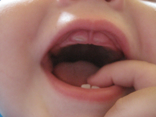 Làm gì khi bé chậm mọc răng - 1