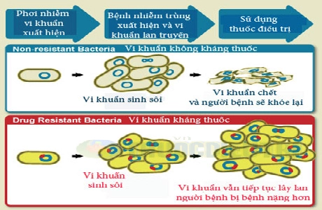 Lý do nên giảm dùng kháng sinh cho trẻ - 1