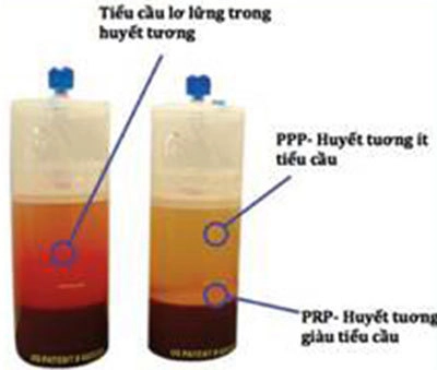 Prp - giải pháp trẻ hóa da - 1