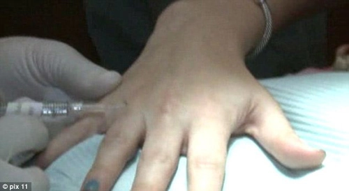 Rộ mốt phẫu thuật ngón tay đeo nhẫn cưới - 2