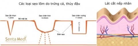 Tác dụng trẻ hóa da của công nghệ trị sẹo 3d - 1