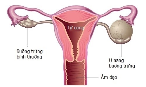 Thiếu nữ mang tiếng chửa hoang đến tận lúc qua đời vì căn bệnh quái ác - 3