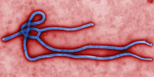 Vì sao virus ebola nguy hiểm - 1