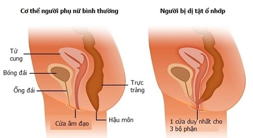 Xuất hiện người phụ nữ mang thai dù chỉ quan hệ bằng cửa sau - 1