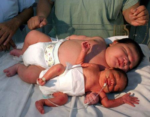 8 bé sơ sinh vừa chào đời đãto nhất thế giới - 3