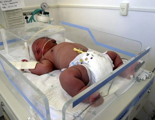 8 bé sơ sinh vừa chào đời đãto nhất thế giới - 4